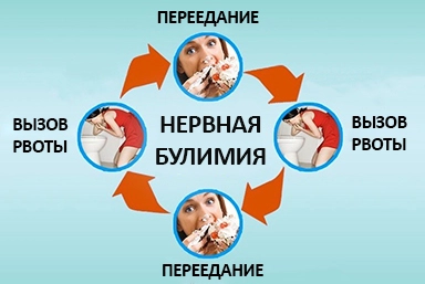 Лечение булимии в Лабинске